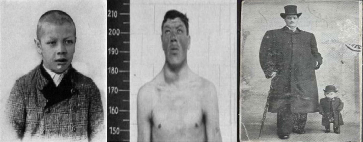 Tiếp đến, thị lực và thính giác của Rainer ngày càng suy giảm. Ông qua đời ở tuổi 51. Vào thời điểm tử vong, chiều cao của ông đo được là 2,3m. Ông trở thành người cao nhất Áo khi ấy.