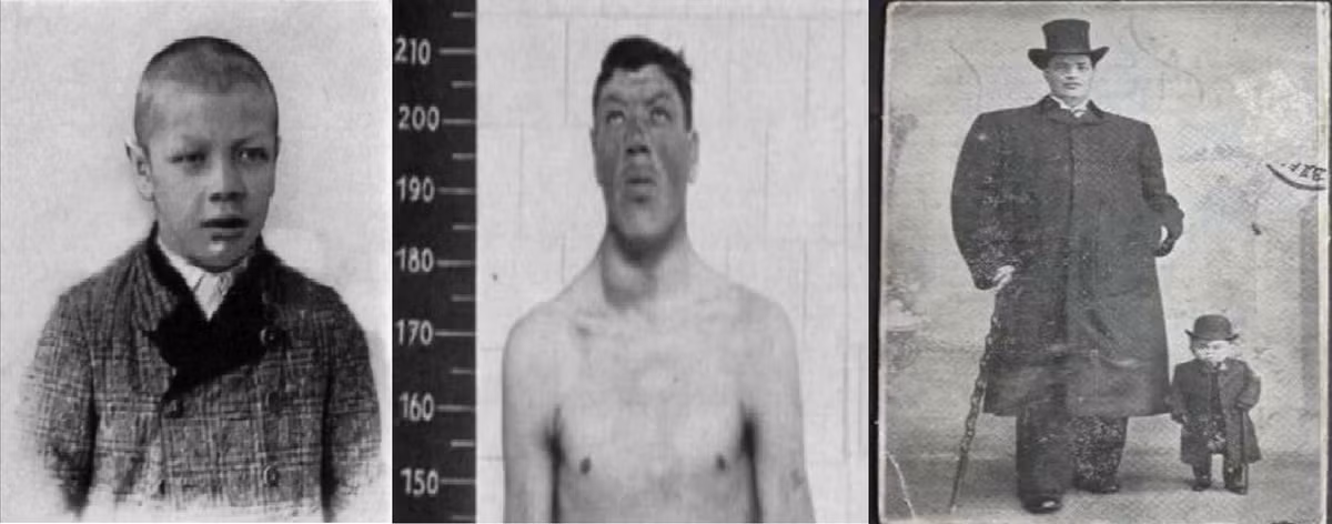 Tiếp đến, thị lực và thính giác của Rainer ngày càng suy giảm. Ông qua đời ở tuổi 51. Vào thời điểm tử vong, chiều cao của ông đo được là 2,3m. Ông trở thành người cao nhất Áo khi ấy.