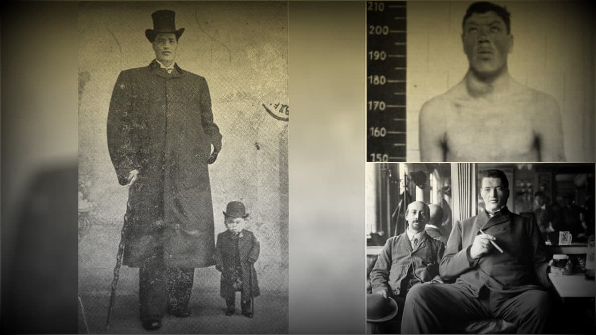 Thêm nữa, các bác sĩ còn phát hiện ông Rainer có một khối u đè lên tuyến yên. Vì vậy, các bác sĩ tiến hành phẫu thuật loại bỏ khối u để làm chậm quá trình phát triển chiều cao của ông.