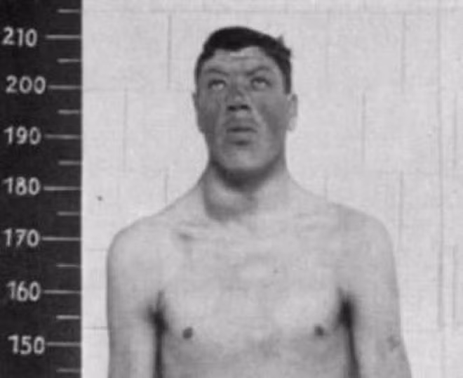 Điều kỳ lạ xảy đến với Rainer kể từ khi 21 tuổi. Chiều cao của ông không ngừng tăng lên. Đến năm 32 tuổi, ông đạt được chiều cao lên tới 2,1m.