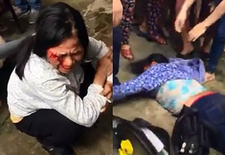 Chị Bảy (trái), là một trong hai người phụ nữ (cùng bà Nguyễn Thị Phúc -SN 1965, ở xã Sơn Công huyện Ứng Hòa, Hà Nội) đi bán tăm bị đánh oan ở xã Phú Minh (huyện Sóc Sơn, TP Hà Nội) vì người dân cho rằng, họ đến bắt cóc trẻ em.