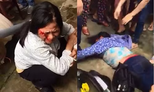 Loi ke cua nguoi phu nu bi danh vi nghi bat coc tre em o Ha Noi-Hinh-4