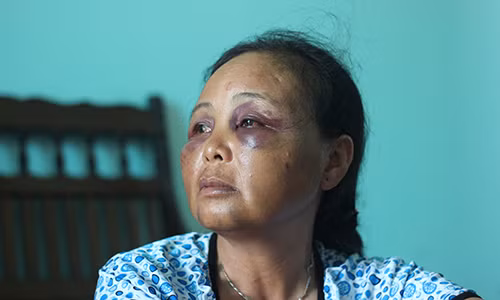 Loi ke cua nguoi phu nu bi danh vi nghi bat coc tre em o Ha Noi