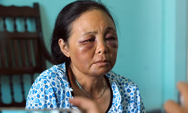 Hai nguoi phu nu bi danh vi nghi bat coc tre: Nguoi la xin rut don