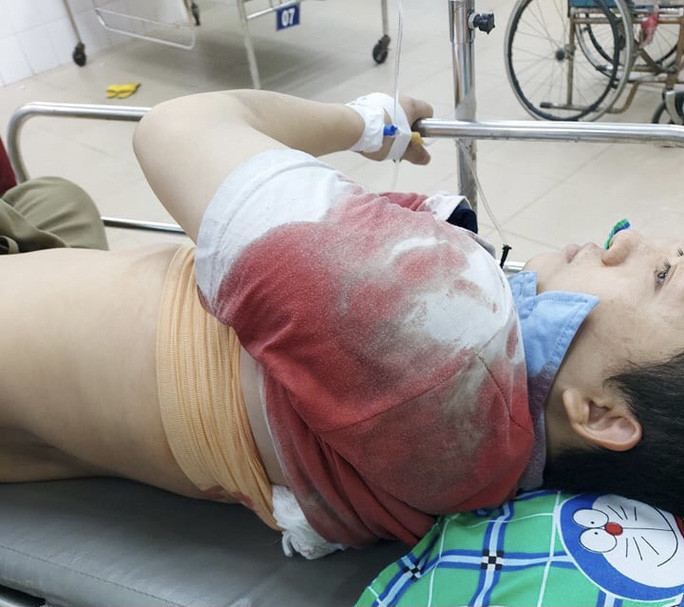  Nhóm côn đồ liều lĩnh chặn xe, đâm chém đôi vợ chồng trẻ: Ngày 25/3, Công an tỉnh Đồng Nai cho biết đang điều tra làm rõ vụ, trên đường đi làm về, chị Trần Thị Thùy (23 tuổi), và chồng là anh Vũ Đình Bình (ngụ huyện Nhơn Trạch, tỉnh Đồng Nai) bị 6 đối tượng hung hãn chặn xe rồi ra tay đâm chém khiến 2 người trọng thương xảy ra vào tối 23/3. 