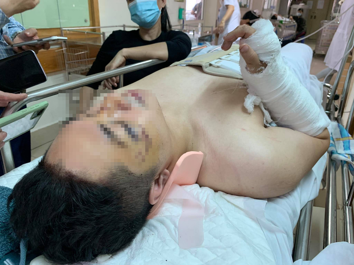 Vu thung san chung cu Meco Complex: Nan nhan bi gay tay, cot song