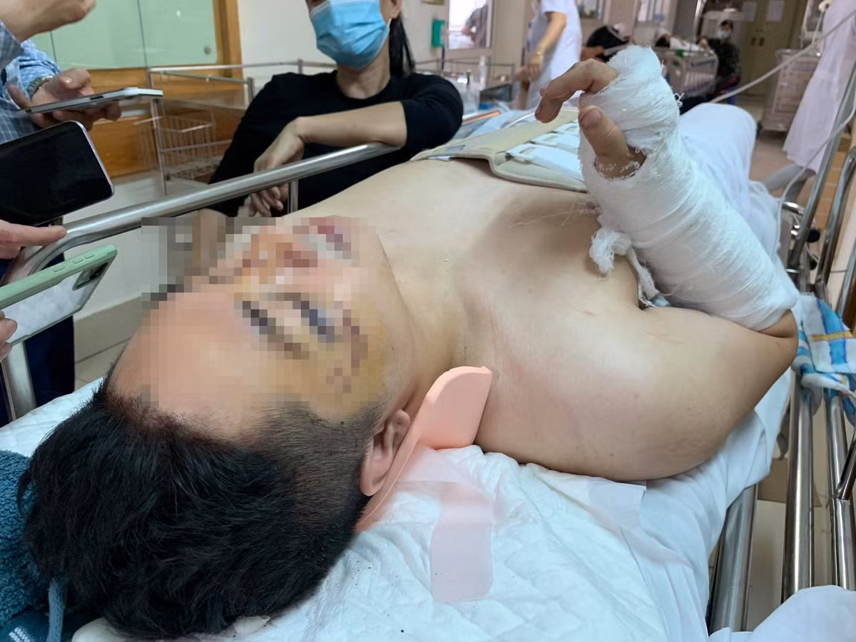 Vu thung san chung cu Meco Complex: Nan nhan bi gay tay, cot song