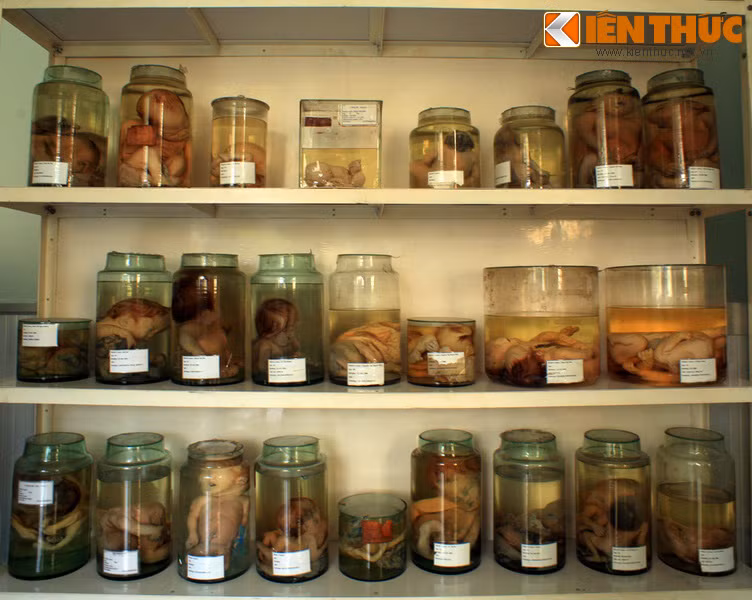 Noi dau da cam vãn am ỉ sau 40 nam giải phóng-Hinh-3