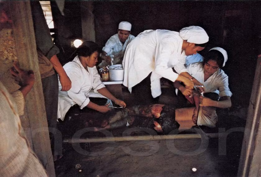 Trong vùng giải phóng, bom đạn chưa nổ vẫn tiếp tục gây thương vong cho người dân. Trong ảnh, một phụ nữ nông dân bị thương do cuốc phải bom bi chưa nổ được điều trị ở bệnh viện Triệu Độ.