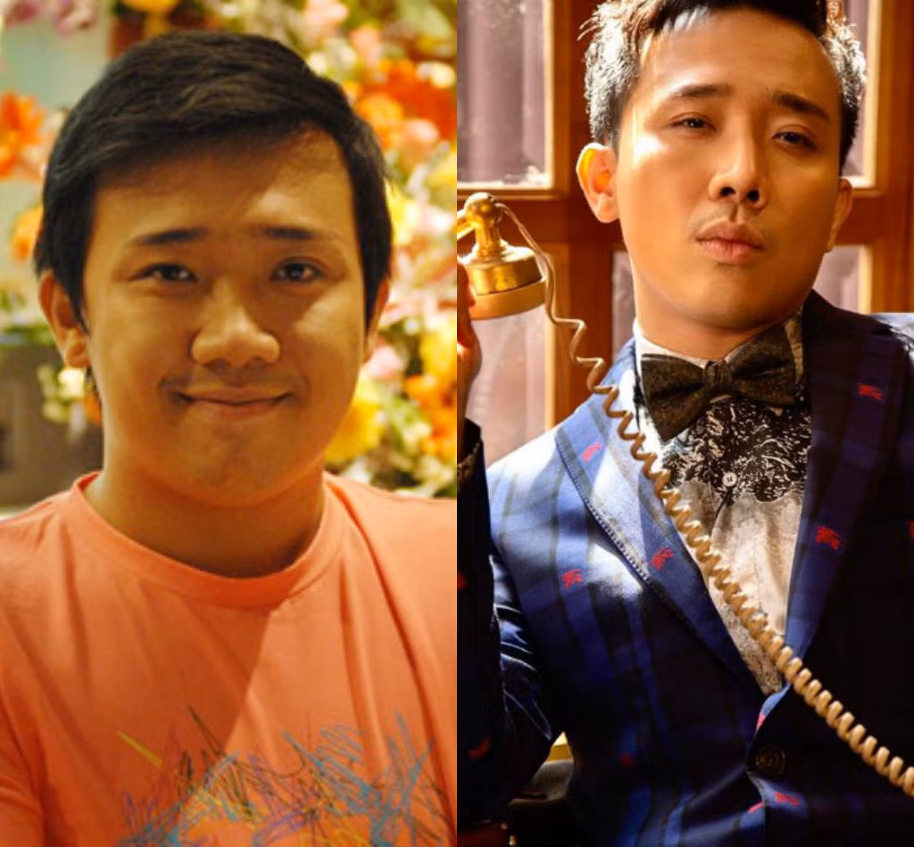 Trấn Thành từng sở hữu một chiếc mũi khá to và thân hình mũm mĩm khiến anh không được tự tin thuở mới vào nghề. Cuối cùng, ông xã của Hari Won quyết định tìm đến phẫu thuật thẩm mỹ. Sau lần “trùng tu nhan sắc” với vẻ ngoài cuốn hút và nam tính, Trấn Thành ngày càng nhận được nhiều tình cảm của công chúng.