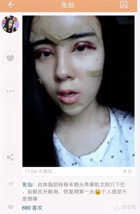 Thảm họa thẩm mỹ Lý Ân Hy trở thành chủ đề bàn tán rôm rả trên mạng xã hội Trung Quốc. Cô người mẫu tuổi teen bị các fan ném đá tả tơi vì quyết định thừa thãi và suy nghĩ thực sự khác người của cô.