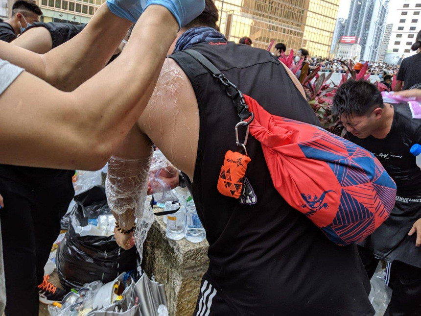 Nhiều người biểu tình bị bỏng do hơi cay và được những người khác sơ cứu bằng nước lạnh. Ảnh: SCMP.