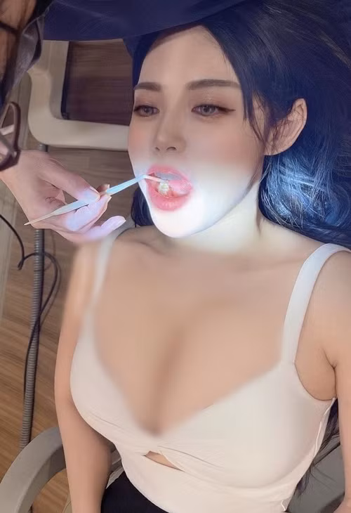 Những ngày gần đây, hình ảnh một hot girl đi khám răng được lan truyền rộng rãi trên mạng xã hội. Đa số mọi người đều khen ngợi cô nàng xinh đẹp nhưng ăn mặc quá phản cảm.