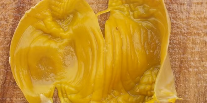 Ngoài ra, trong kê nội kim có các protid các chất vị kích tổ (ventriculin) cùng 17 loại amino acid, keratin, pepsin, ventriculin, ammonium chloratum, vitamin B1, B2 có tác dụng làm có tác dụng điều trị viêm đại tràng mãn tính, sỏi mật, sỏi tiết niệu.