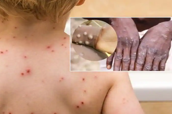 Biet gi ve vac xin phong dau mua khi duoc Chau Au phe duyet?