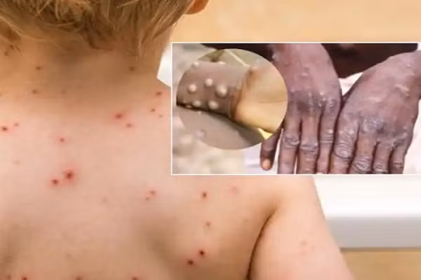 Biet gi ve vac xin phong dau mua khi duoc Chau Au phe duyet?