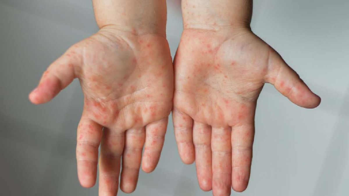 Tre em mac dau mua khi co nguy hiem?