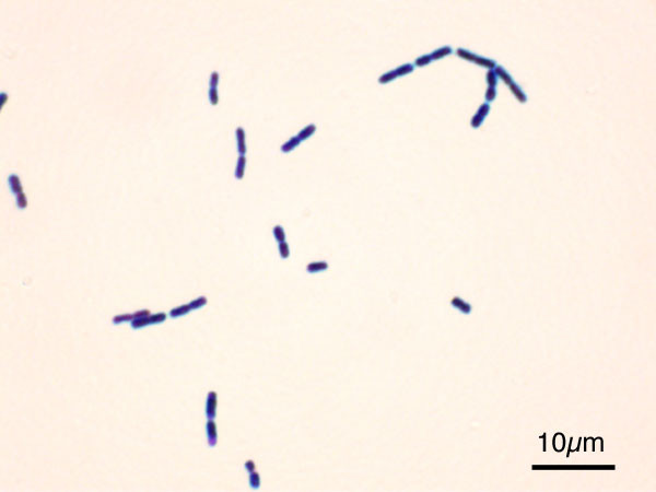 Chiều 10/2, Sở Y tế tỉnh An Giang cho biết cơ quan chức năng đã xác định được nguyên nhân gây ra ngộ độc chè đậu trắng khiến 38 người phải nhập viện. Theo đó, tác nhân gây ngộ độc là do nhiễm khuẩn và độc tố của vi khuẩn - độc tố của Bacillus cereus. Ảnh: Wikipedia.