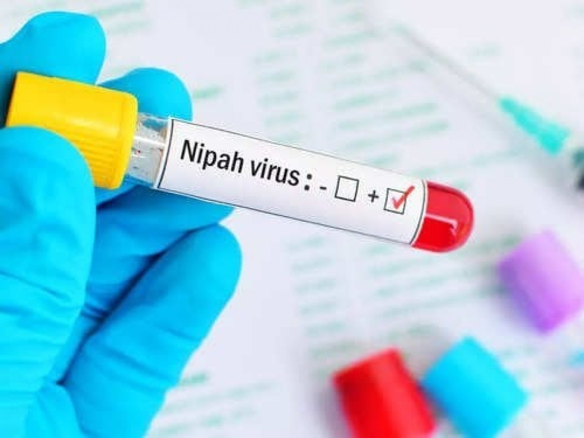 Giới chức bang Kerala, miền nam Ấn Độ hiện chạy đua với thời gian để kiểm soát ổ dịch do virus Nipah gây ra. Ổ dịch này bùng phát sau khi cơ quan chức năng ghi nhận một bé trai 12 tuổi tử vong ngày 5/9 - chỉ vài ngày sau khi được phát hiện nhiễm virus Nipah.