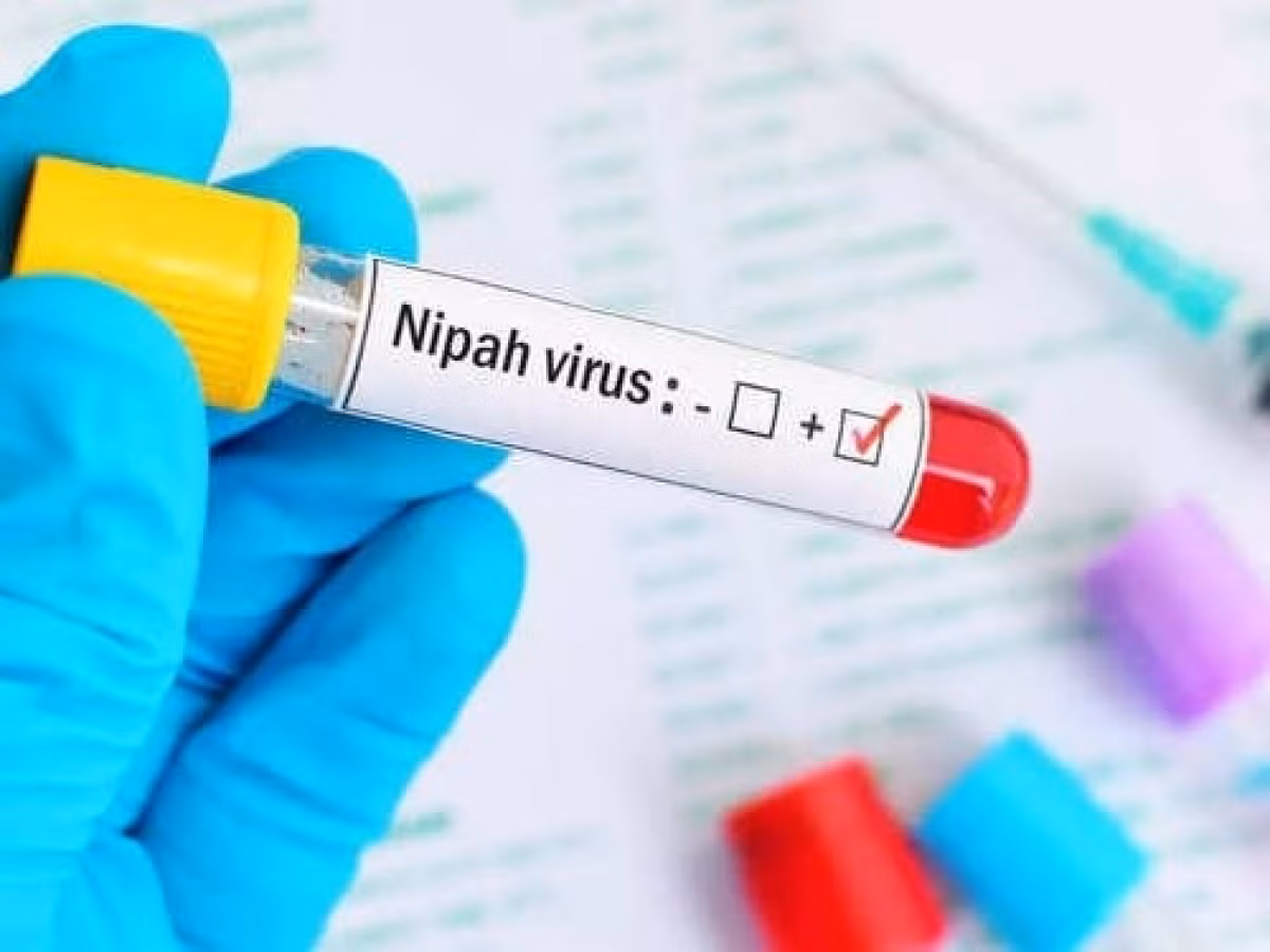 Giới chức bang Kerala, miền nam Ấn Độ hiện chạy đua với thời gian để kiểm soát ổ dịch do virus Nipah gây ra. Ổ dịch này bùng phát sau khi cơ quan chức năng ghi nhận một bé trai 12 tuổi tử vong ngày 5/9 - chỉ vài ngày sau khi được phát hiện nhiễm virus Nipah.