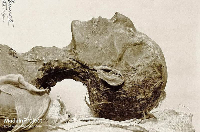 Tại Pháp, các chuyên gia tiến hành kiểm tra và phát hiện sự phân hủy của xác ướp là kết quả do nhiễm nấm. Vì vậy, nhóm chuyên gia nhanh chóng áp dụng phương pháp xử lý thích hợp để ngăn xác ướp phân hủy hoàn toàn. Sau khi hoàn thành, xác ướp được đưa trở lại Ai Cập và Bảo tàng Cairo bằng đường hàng không.