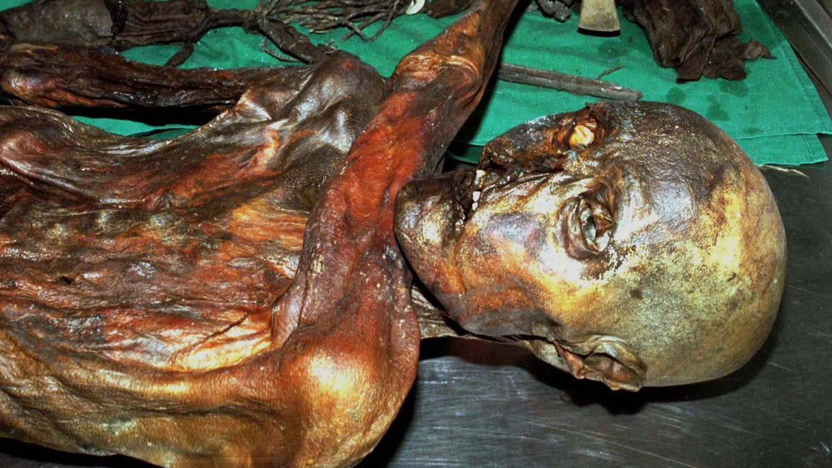 Các chuyên gia phát hiện Otzi chết vì vết thương từ cung tên. Từ đây, một giả thuyết cho rằng người này có thể bị thợ săn khác dùng cung tên bắn chết.