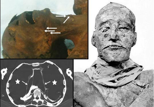 Thế nhưng, đến năm 1156 trước Công nguyên, Ramesses III qua đời một cách bí ẩn. Một số tài liệu cho rằng ông bị giết hại hoặc đầu độc.