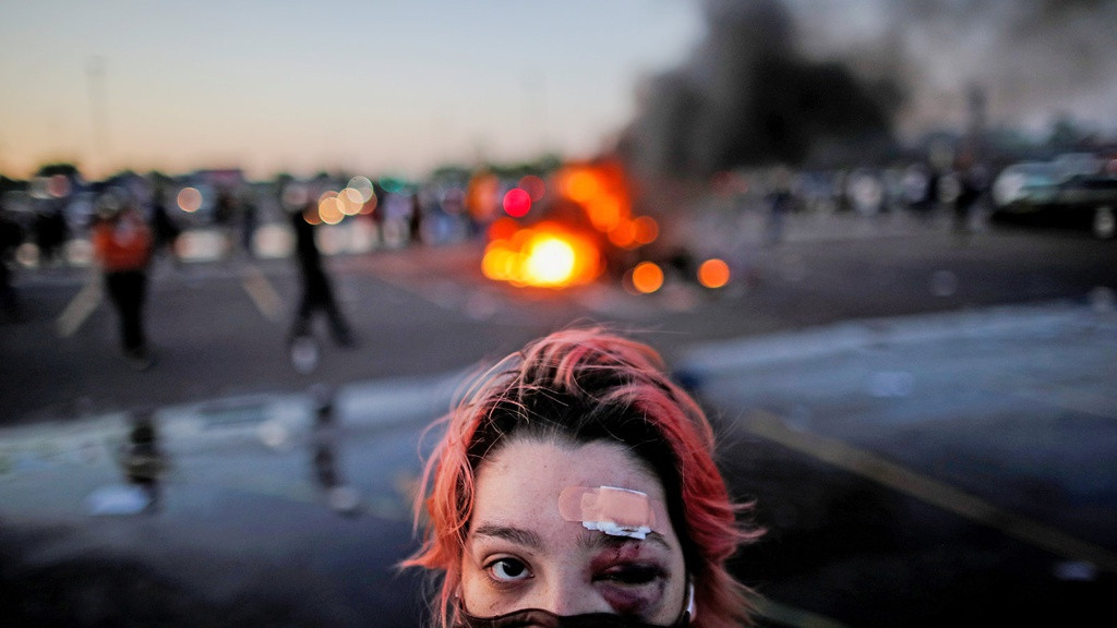 Nguoi da mau bi de chet, Tong thong Trump va ong Obama len tieng-Hinh-4