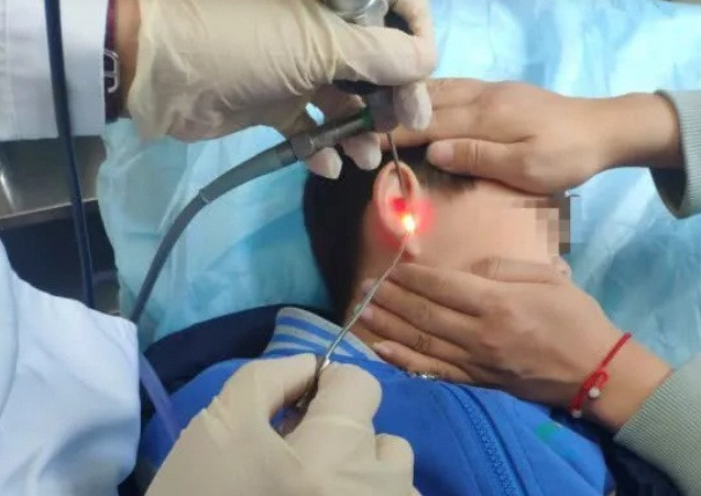 Chuyen la hai hung: Choang vang cau be co cay moc trong tai