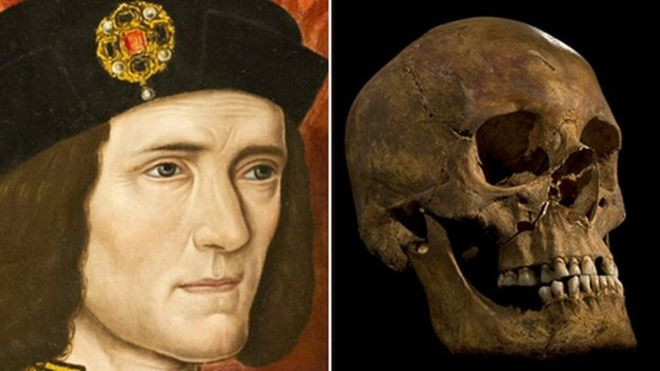 Kết quả kiểm tra thi hài của Vua Richard III cho thấy ông hoàng này có tổng cộng 11 vết thương. Trong đó có 9 chấn thương trên hộp sọ.