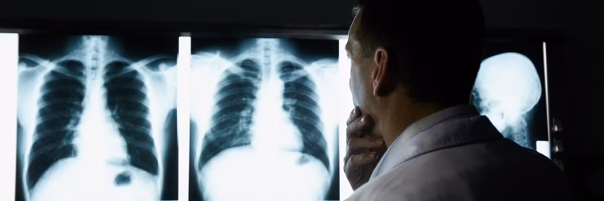 Để ghi nhớ công lao của nhà vật lý Rontgen, người ta dùng họ của ông làm đơn vị đo mức bức xạ. Trong tiếng Đức, tia X vẫn còn được biết tới là tia Roentgen.