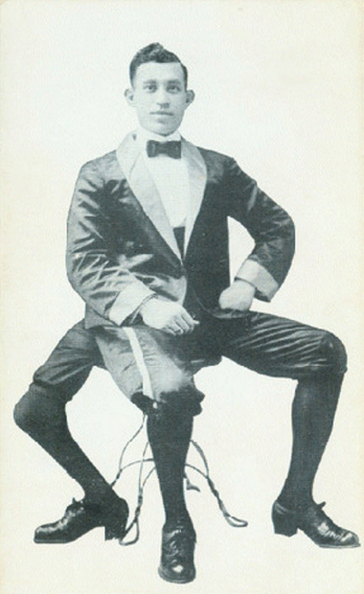 Do Lentini có ngoại hình như vậy nên cha mẹ gửi ông đến một người cô để nuôi dưỡng. Về sau, người họ hàng này lại đưa Lentini tới trại mồ côi cho trẻ em khuyết tật.