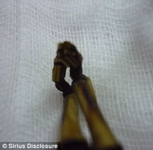 Xác ướp Ata chỉ có 10 cặp xương sườn thay vì 12 cặp như bình thường. Xương của bé gái này bị lão hóa quá nhanh.