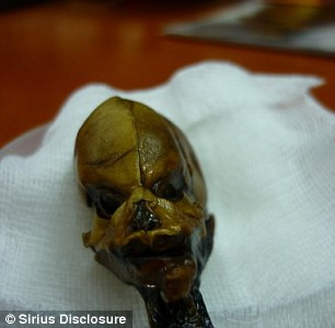 Không chỉ khẳng định Ata là con người, các chuyên gia còn tìm thấy bằng chứng cho thấy bé gái sơ sinh này có nhiều đột biến gene gắn liền với chứng lùn, vẹo cột sống và nhiều bất thường ở hệ cơ và xương.