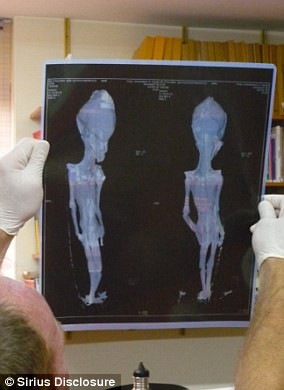 Chính vì là bào thai chưa phát triển đầy đủ nên xác ướp này chỉ có 10 cặp xương sườn - một điều hiếm thấy đối với con người.