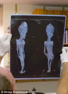 Chính vì là bào thai chưa phát triển đầy đủ nên xác ướp này chỉ có 10 cặp xương sườn - một điều hiếm thấy đối với con người.