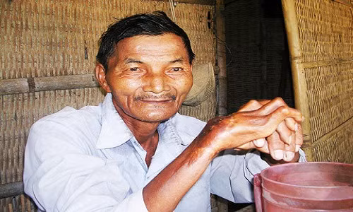 Một trong những người đặc biệt nhất thế giới là ông Thái Ngọc ở Quảng Nam, Việt Nam. Dư luận thế giới không khỏi kinh ngạc khi hay biết ông đã không ngủ trong suốt gần nửa thế kỷ.