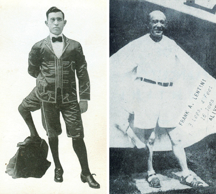 Năm lên 8 tuổi, ông di cư sang Mỹ và từng bước trở thành một diễn viên xiếc danh tiếng. Những buổi diễn của ông thu hút rất đông khán giả. Thậm chí, ông còn viết và xuất bản cuốn tự truyện về cuộc đời mình.