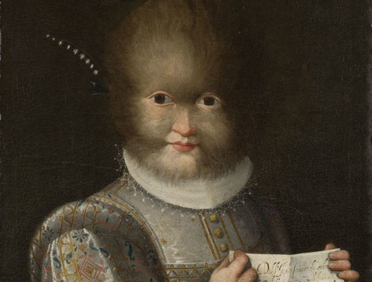 Cha mẹ đã đặt tên cho người con có ngoại hình khác thường ấy là Petrus Gonsalvus. Vì có diện mạo không như những đứa trẻ khác, cha mẹ của Gonsalvus nghĩ rằng, cậu bé là hiện thân của quỷ dữ.