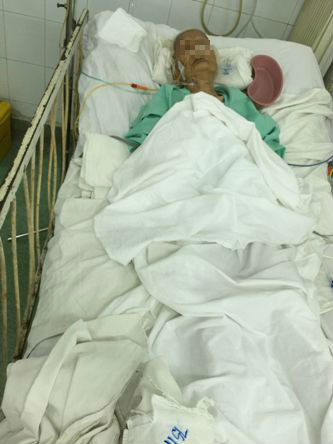 Bà cụ 104 tuoi gãy xuong dui 1 tuàn dã dúng duọc