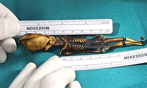 Năm 2013, các chuyên gia phát hiện một hài cốt "người ngoài hành tinh" tý hon giống hệt con người ở Chile. Bộ hài cốt này có gương mặt kì dị, thân hình nhỏ bé và khá giống con người. Tuy nhiên, chiều cao toàn bộ người tí hon chỉ khoảng 15,2 cm. Một số người suy đoán rằng, rất có thể đây là tổ tiên của một giống người ngoài hành tinh nào đó.Tuy nhiên, kết quả kiểm tra ADN cho thấy đây là hài cốt của con người.