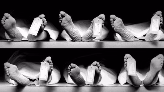 Năm 1915, ba nguyên nhân gây tử vong hàng đầu ở Mỹ là bệnh tim, viêm phổi/cúm và bệnh lao.