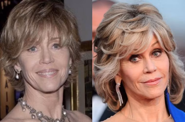 Vẻ đẹp của nữ diễn viên kiêm người mẫu Jane Fonda 78 tuổi luôn khiến mọi người ghen tị và chính bà thừa nhận đã từng phẫu thuật thẩm mỹ để có được vẻ đẹp lâu bền như vậy. Hình ảnh Jane Fonda năm 2000 và năm 2015 (phải).