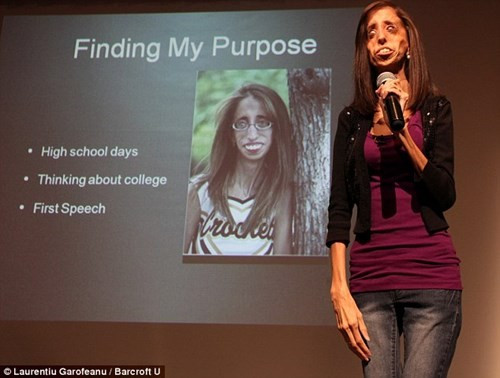 Nhưng khác với suy nghĩ của nhiều người, Lizze lấy lại sự thăng bằng rất nhanh, cô không cho những kẻ ác ý kia được phép làm mình đau khổ thêm 1 lần nào nữa.