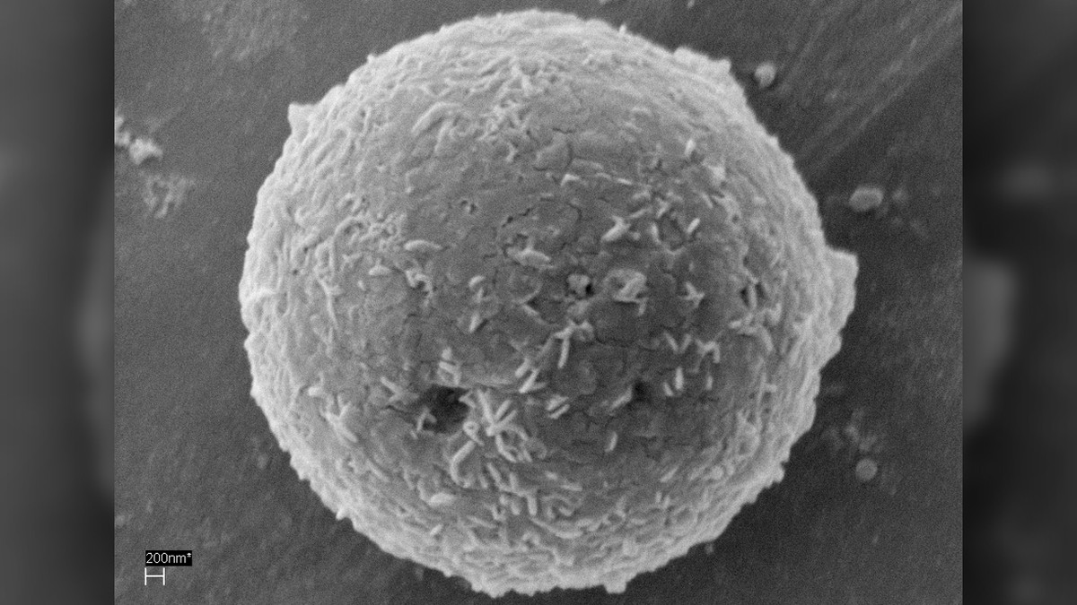 Từ đây, các chuyên gia giải mã được một số chi tiết lạ liên quan đến cái chết của người đàn ông này. Cụ thể, các kiểm tra cho thấy người này qua đời khi khoảng 35 - 45 tuổi.