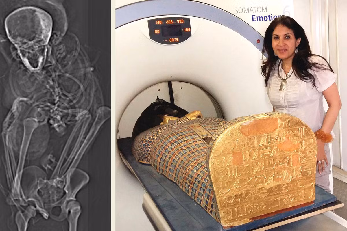 Đôi tay biến dạng của pharaoh Seqenenre Taa II cho thấy nhà vua Ai Cập có thể đã bị binh sĩ Hyksos bắt trên chiến trường. Sau đó, 2 tay của ông bị trói sau lưng.