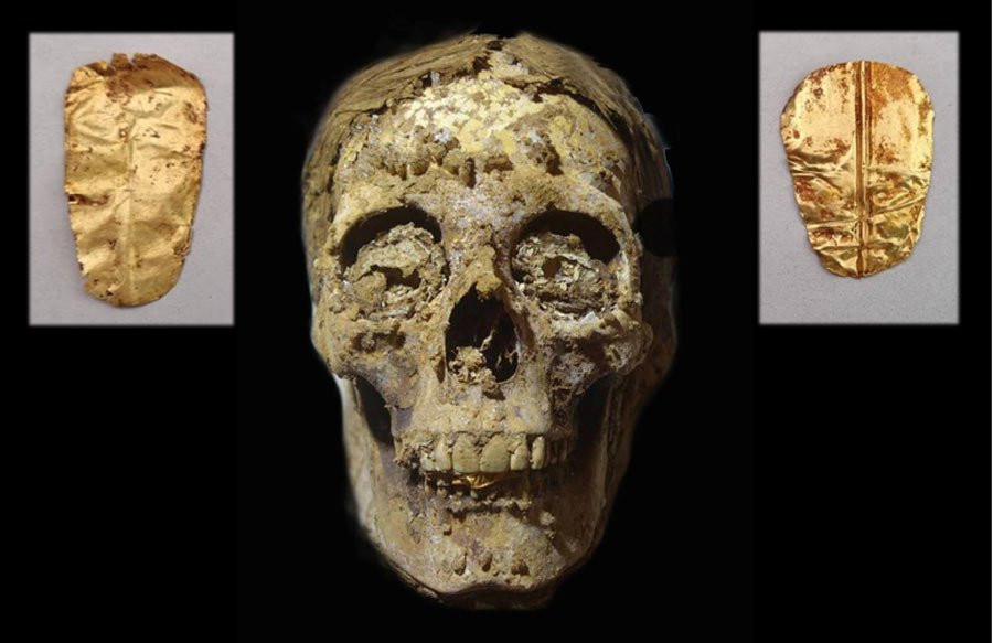 Trái ngược với hài cốt người đàn ông, thi hài người phụ nữ ở trong tình trạng kém hơn. Không những vậy, ngôi mộ có dấu hiệu bị kẻ trộm xâm phạm, đào xới.