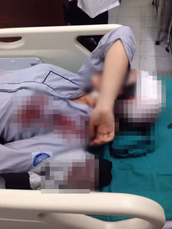 Ha Noi: Cong an trieu tap hai nghi can danh nu sinh nhap vien