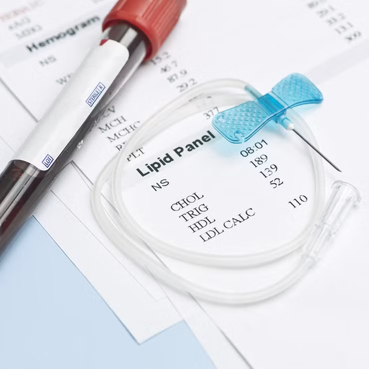 Xét nghiệm máu sẽ cho bạn cái nhìn toàn cảnh về tình trạng sức khỏe cơ thể hiện tại để có thể đưa ra những lời cảnh báo sớm nhất giúp cải thiện tình hình. Nên tham gia xét nghiệm máu mỗi hai hoặc ba năm một lần.