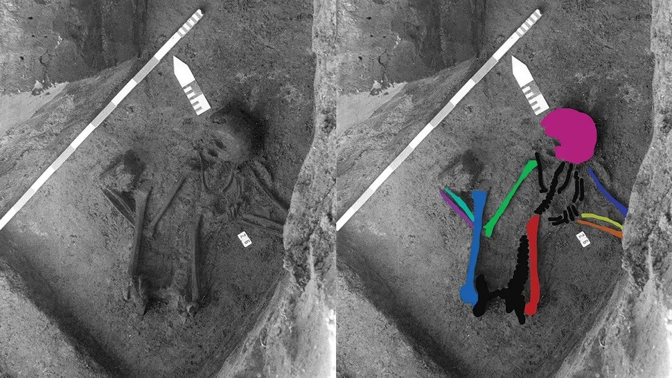 Việc phát hiện ngôi mộ chứa hài cốt trong tư thế bào thai được tạo thành từ xương của ít nhất 5 người là điều bất thường trong một nghĩa trang thời La Mã. Tuy nhiên, các chuyên gia đã tìm thấy một chiếc ghim cài bằng xương kiểu La Mã ở gần hộp sọ và kết luận, ngôi mộ này nhiều khả năng cũng thuộc thời La Mã. Ảnh: Paumen, Wargnies and Demory, Fédération Wallonie-Bruxelles.